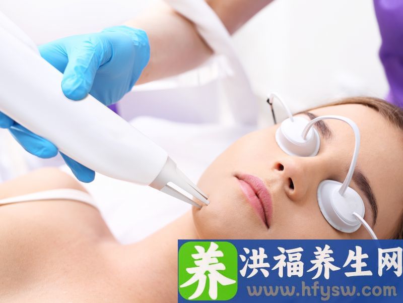 雀斑激光去除效果怎么样 祛斑的复发率高吗？