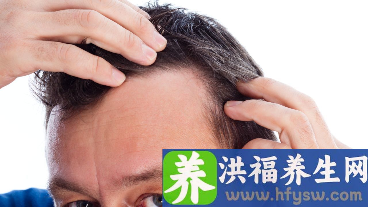 雄激素测定有什么用