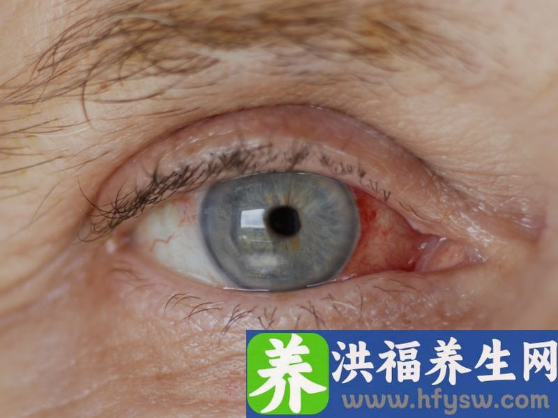 45以后患白内障可能会导致失明，需警惕，做好4点有助预防白内障