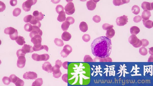 怎么判断诺如病毒还是细菌感染