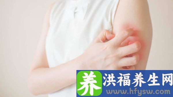 干燥综合征的临床表现有哪些