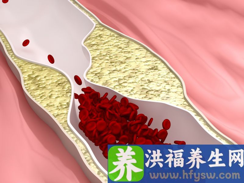 一直吃素，血脂为什么还是这么高？提醒：45岁后，这些食物可以吃