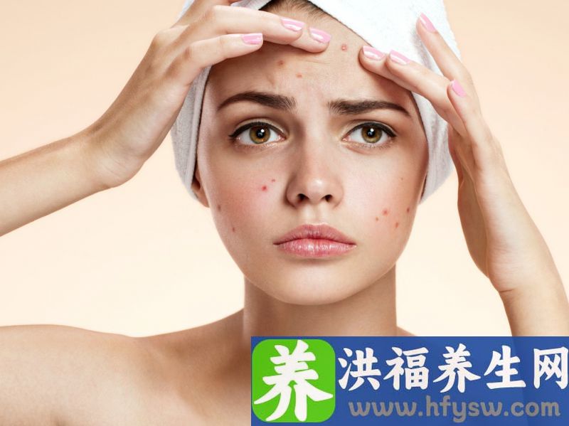 什么是皮下分离痘坑术？祛痘坑后注意事项有这些
