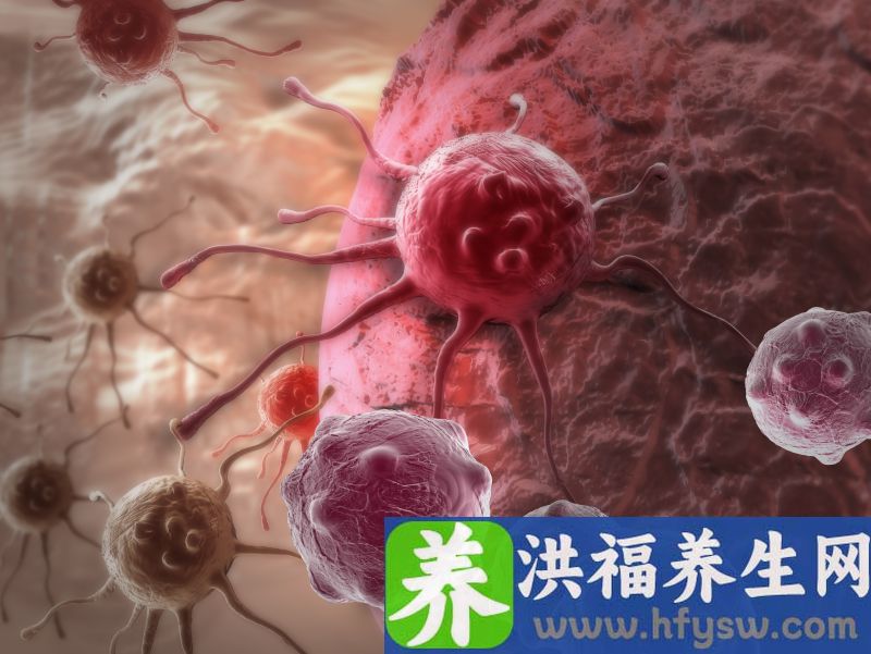 膀胱癌的症状有哪些