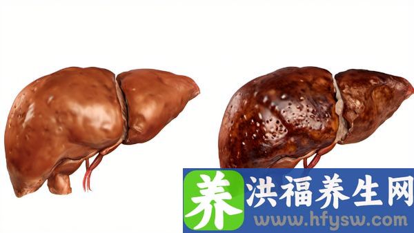 什么是转氨酶
