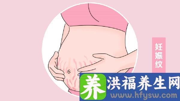 做腹壁整形去妊娠纹的步骤及注意事项