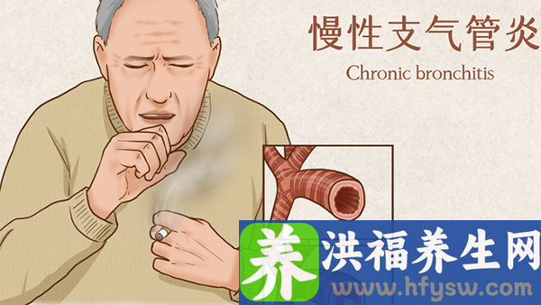 慢性支气管炎是如何分期的