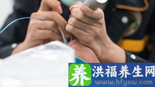 小儿鞘膜积液手术最佳年龄是多大