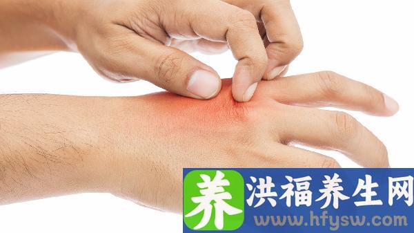 黑色素瘤是皮肤癌的一种吗