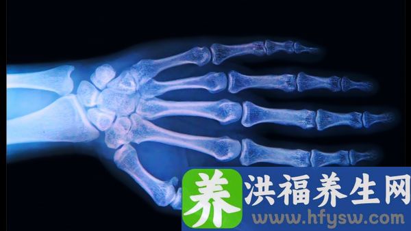 手指关节痛弯曲会痛如何治疗