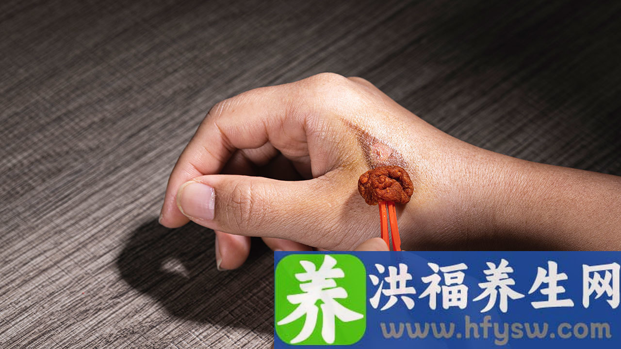 碘剂和碘-131有什么区别