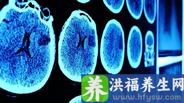 宝宝轻微脑震荡怎么办