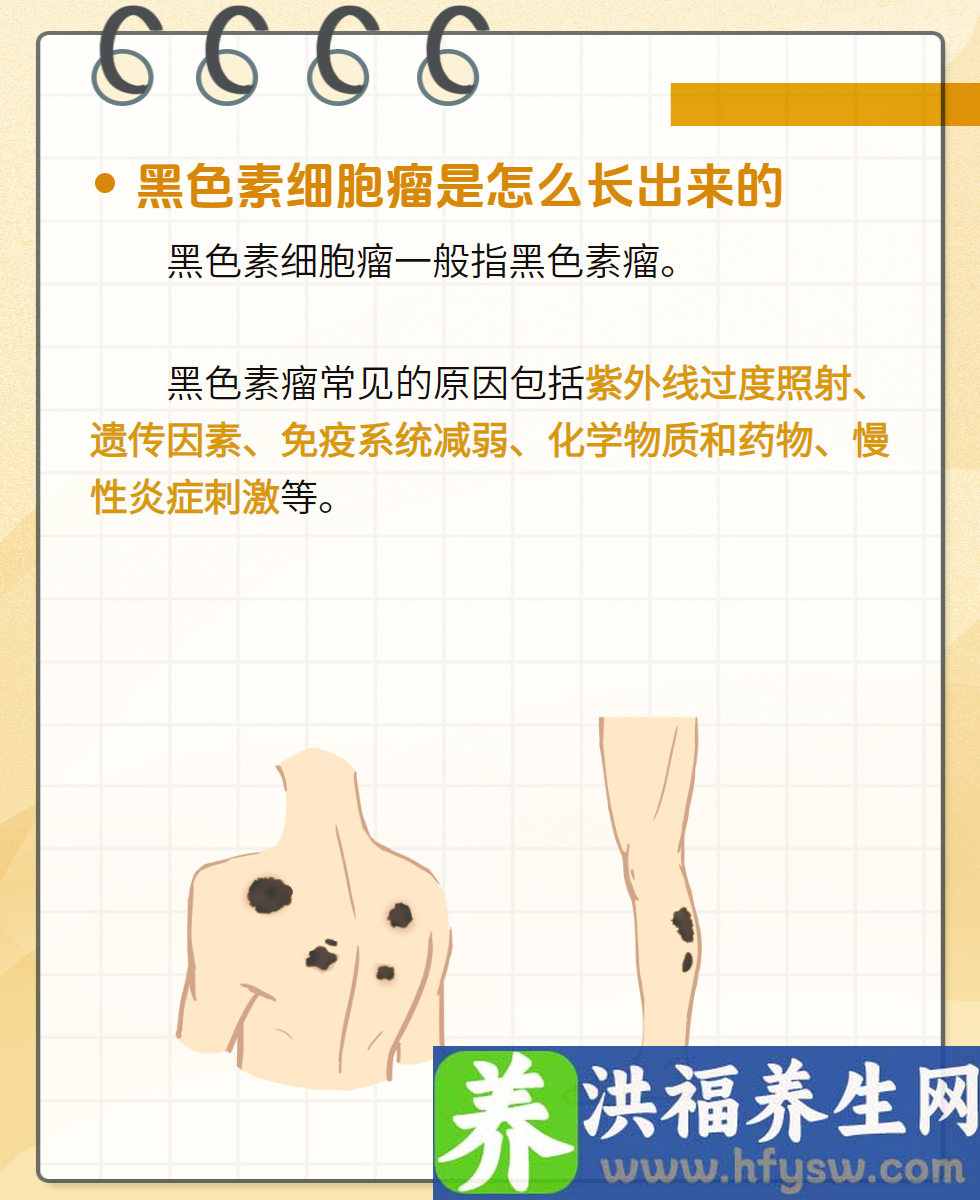 痣在什么情况下会变成黑色素瘤?跟这5个因素有关