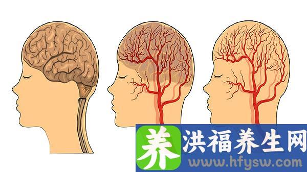 大脑语言区受损能恢复吗