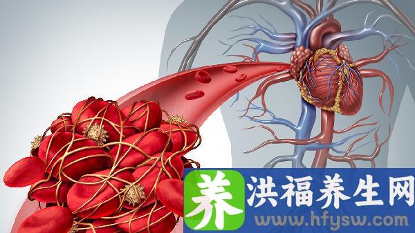 老年人吃什么对心血管好比较好