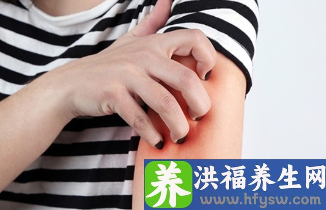 哪些食物对治疗艾滋病有好处？艾滋病患者的饮食原则是什么？