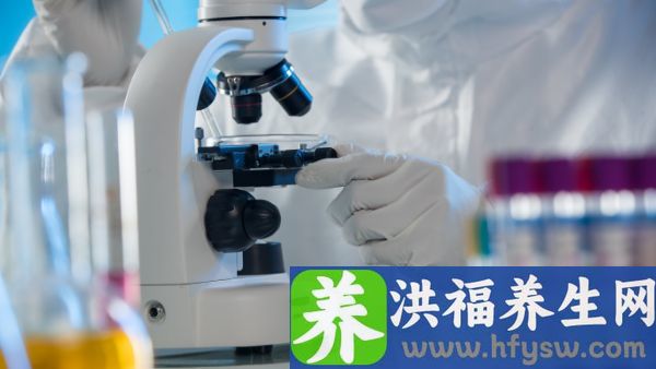 尿糖正常值是多少