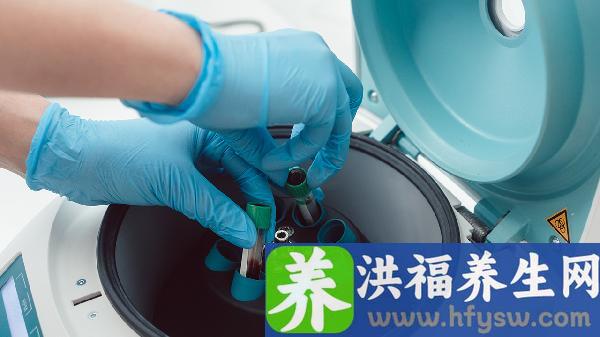 血小板压积0.29问题大吗