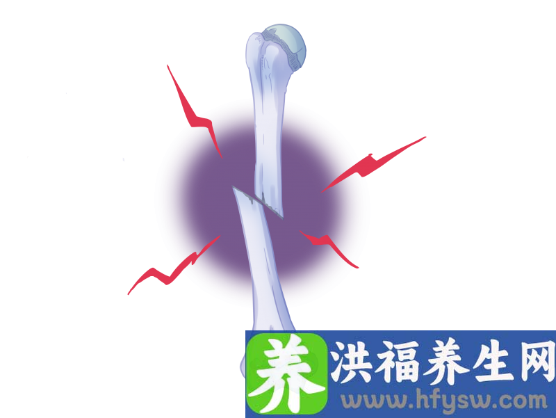“人生最后一次骨折”，一旦发生该如何应对？