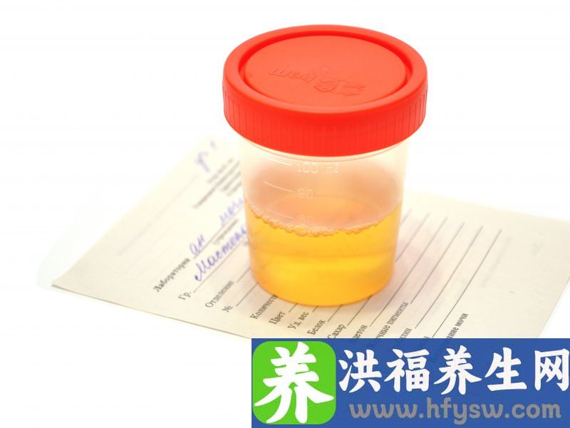 尿液是越黄越好吗？尿液的正常颜色是怎么样的？