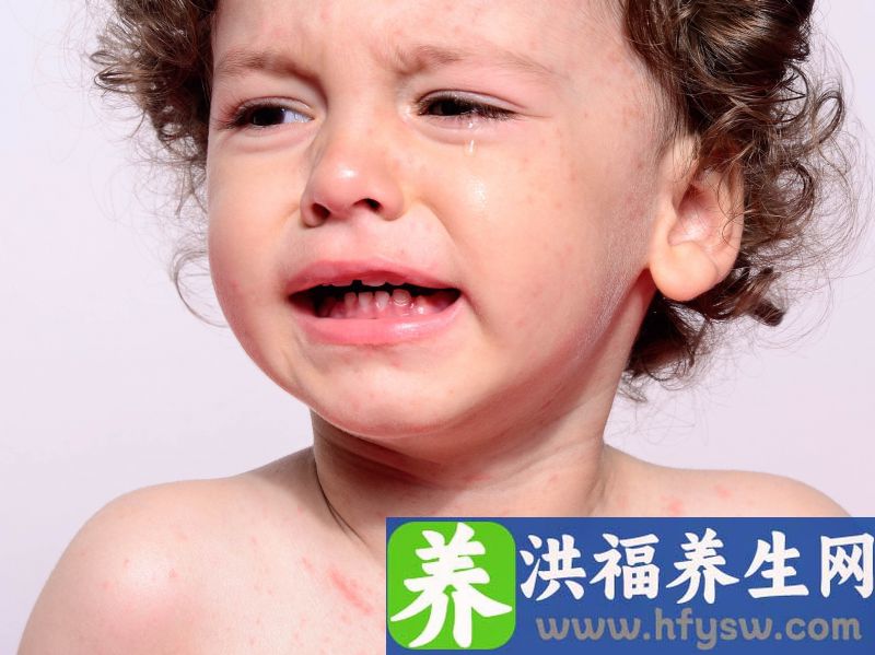 营养障碍的治疗