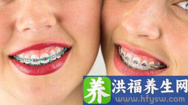 成年人牙齿畸形矫正常见的方法有哪些