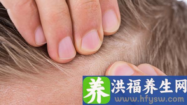 新生儿头皮血肿一般多久可以消除