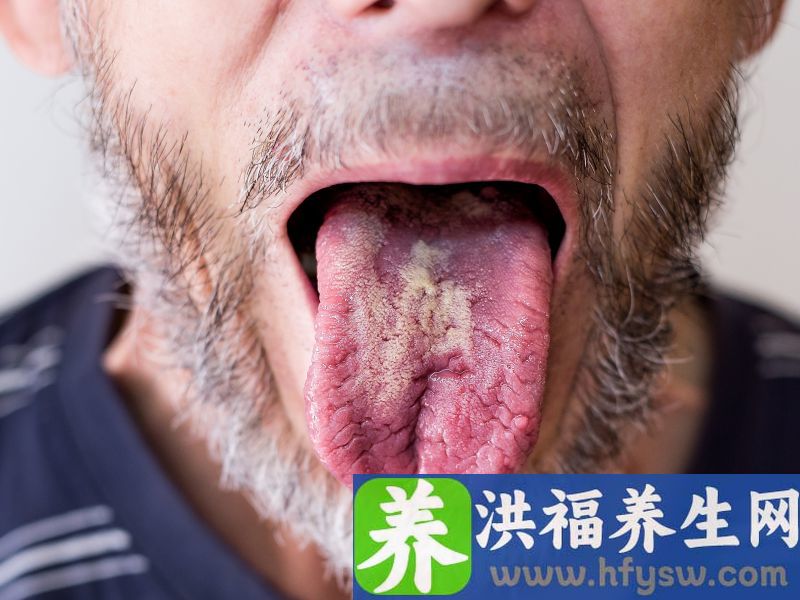 大多数人舌苔出现这2种“情况”，起初毫不在意，发现时胃已病变