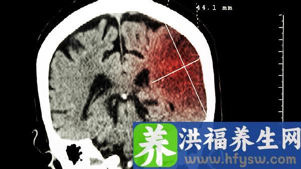 吃啥补脑子提高记忆力效果好