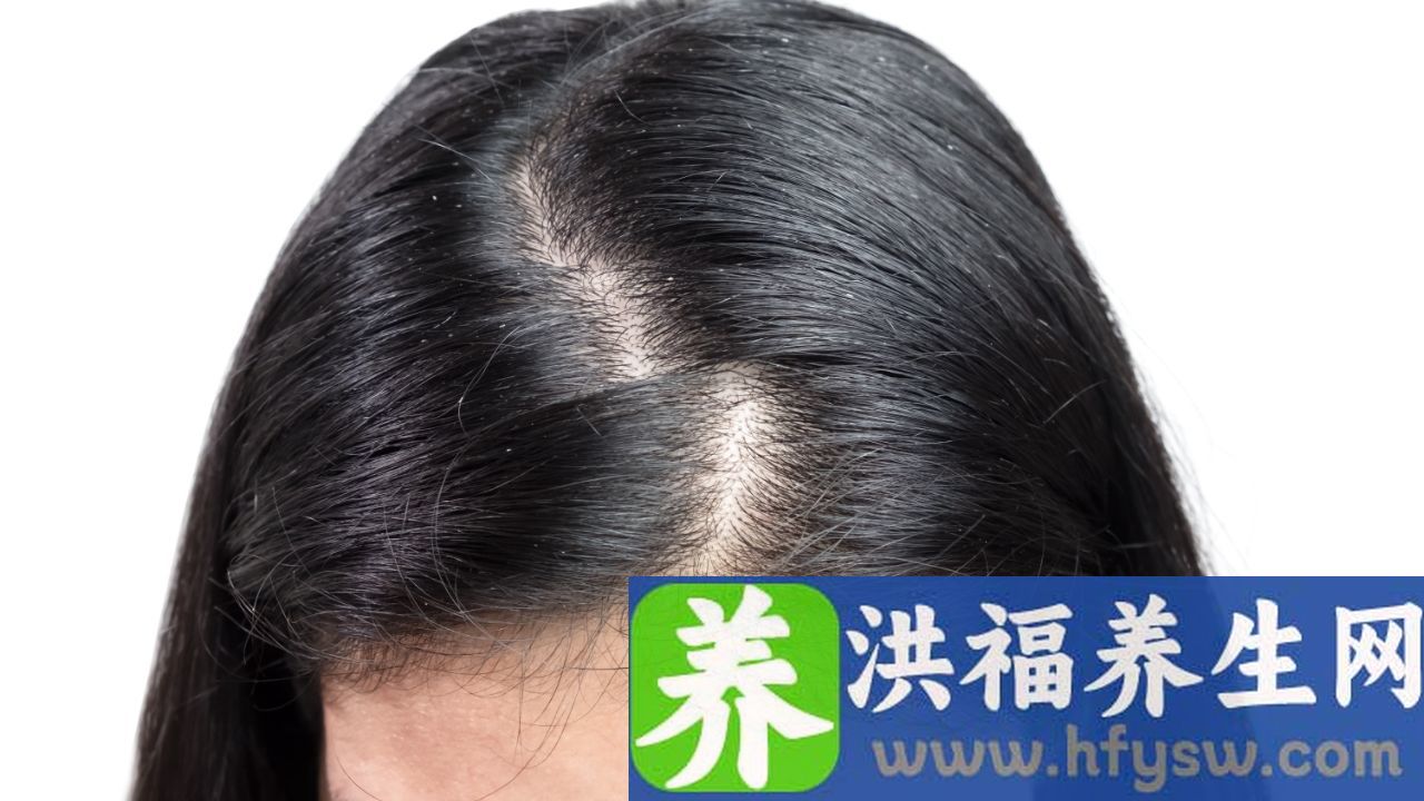 头皮发紧发麻是怎么回事