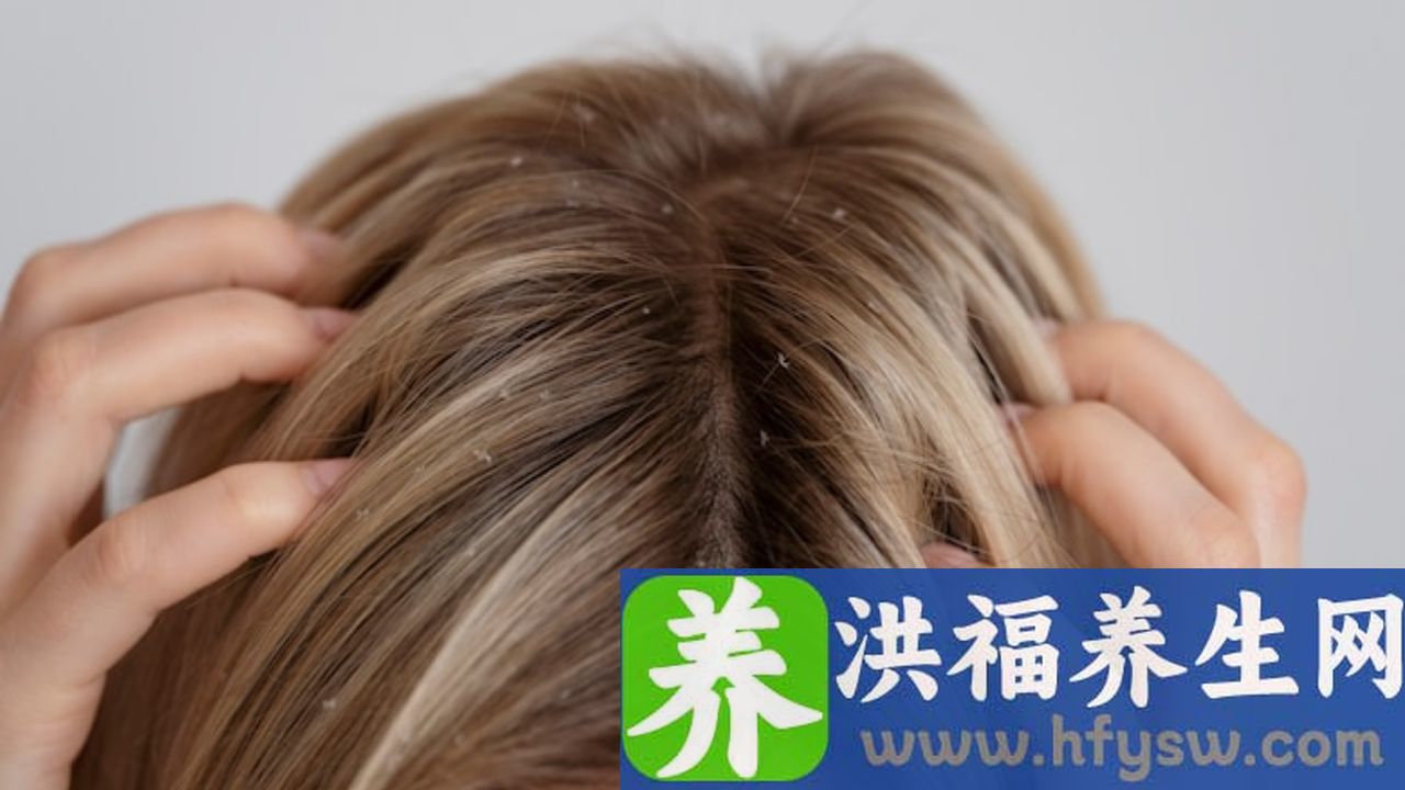 头皮发麻发紧怎么办
