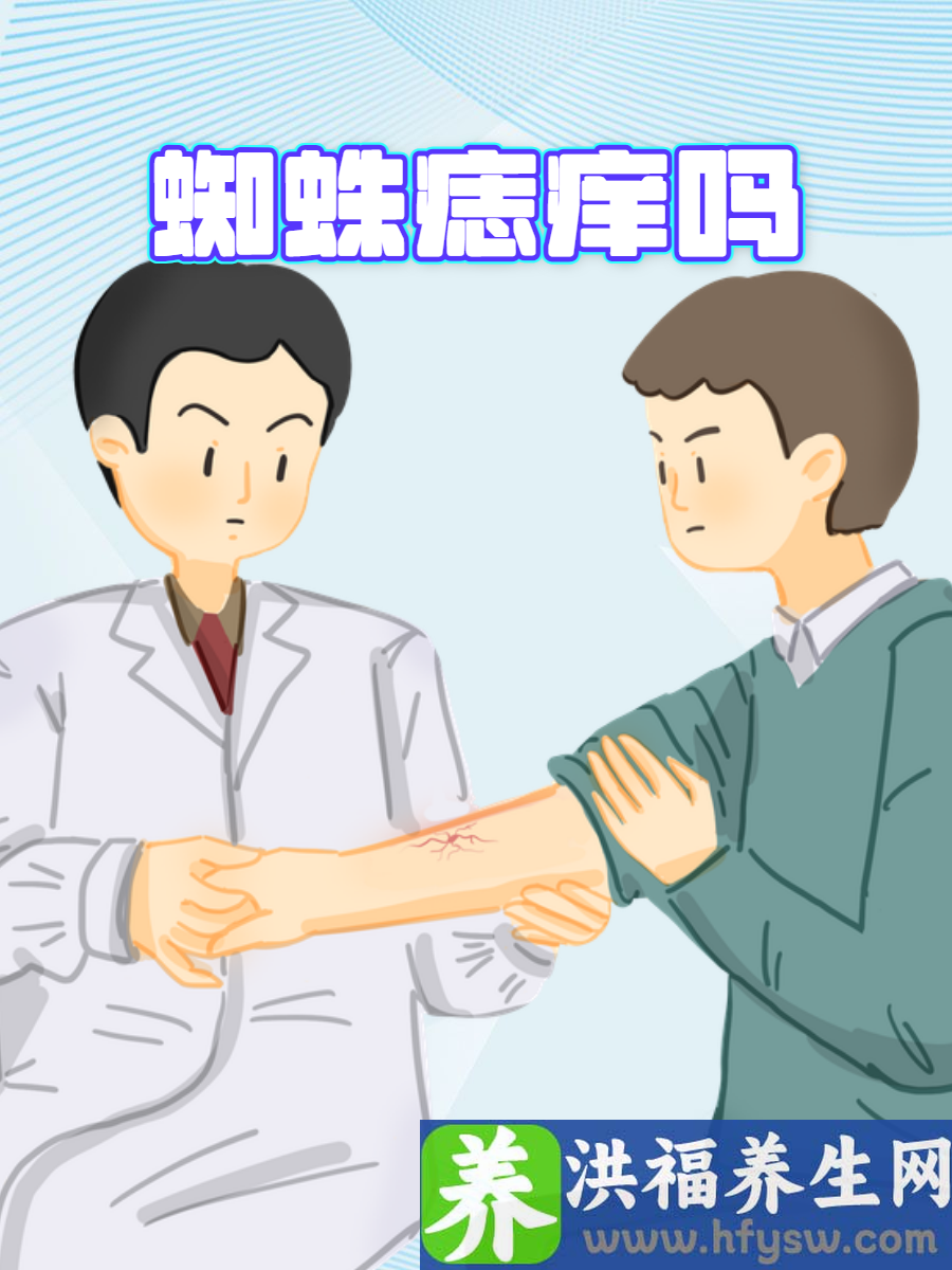 蜘蛛痣痒吗？关于这点疑问为你解答