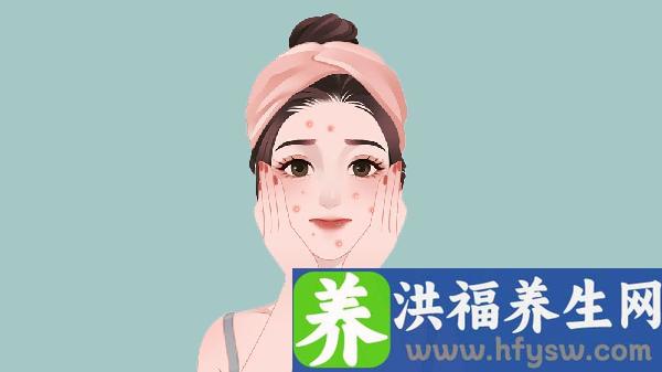 做冷冻治疗去痘疤价格贵不贵
