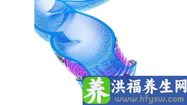 高钾血症会引起呕吐吗
