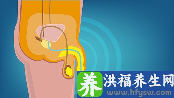 频繁遗精是怎么回事？什么方法能缓解频繁遗精