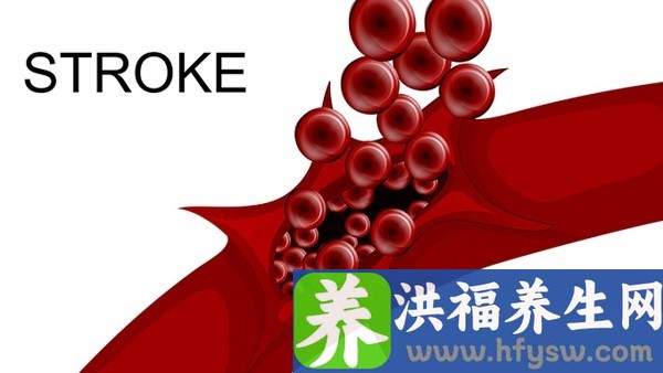 简述高钾血症对心肌的影响