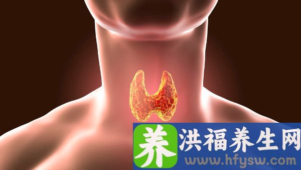 桥本甲状腺炎能治好吗