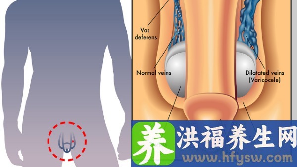 阴茎勃起13厘米算短吗? 阴茎硬的时间不长是怎么回事?