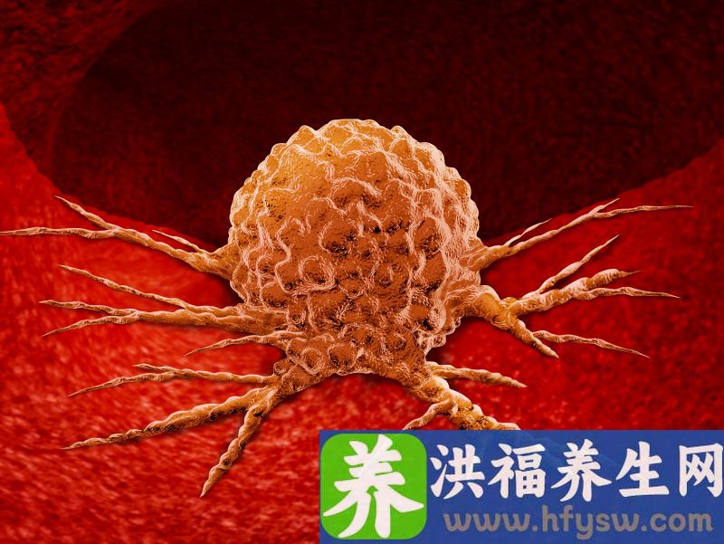 4类食物已被世界卫生组织列为致癌物，再饿也别吃了