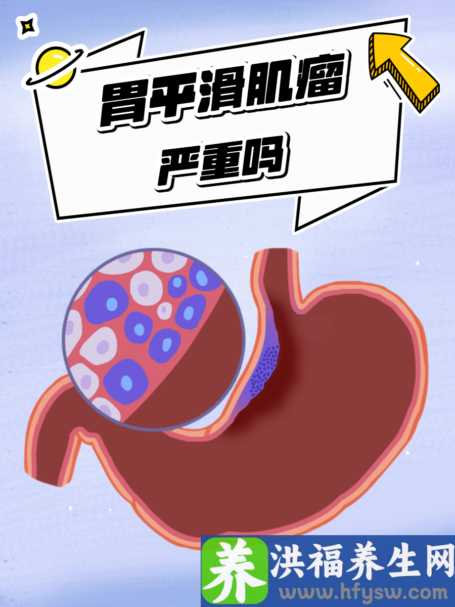 胃平滑肌瘤严重吗？快来了解