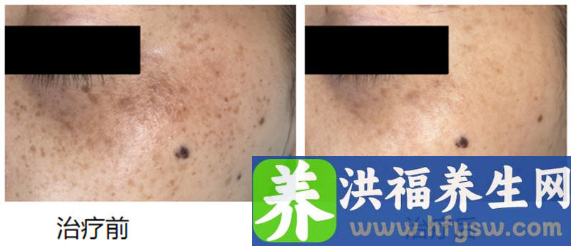 【3.8妇女节】三甲医院能做哪些医美项目？快收藏，让你悄悄变美……