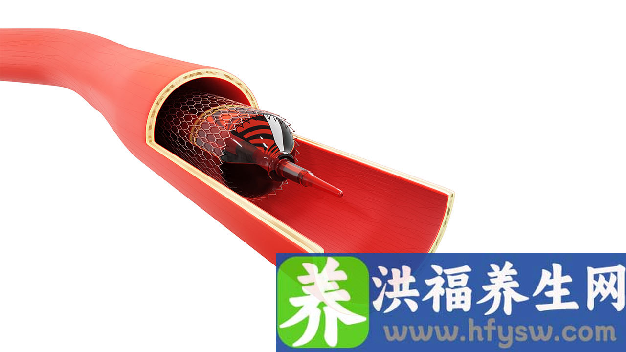 放支架后能喝葡萄酒吗