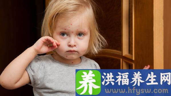 春天脚踝处出红疹子是何原因