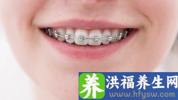 牙齿矫正时怎么样保护牙齿