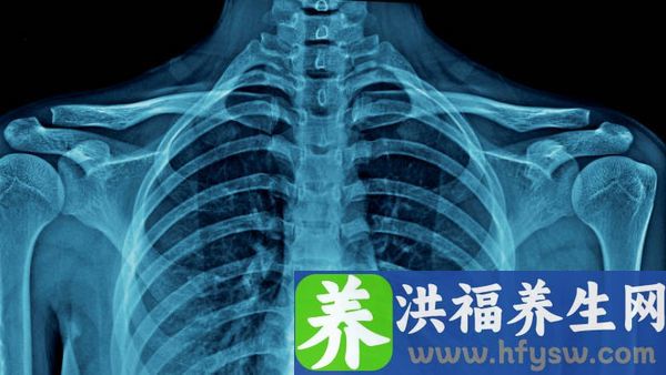 如何判断自己是轻微气胸