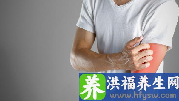 皮肤过敏红痒起疙瘩怎么办？有什么方法能治疗好