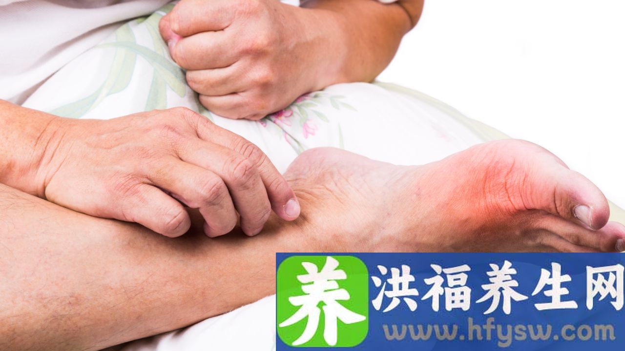 急性痛风几天可以正常走路
