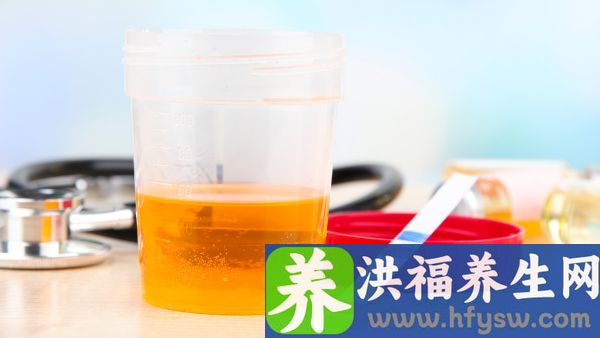 尿液分析隐血2 是什么意思