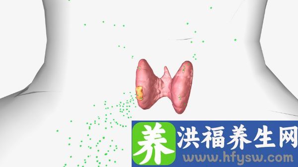 促甲状腺激素偏高的原因
