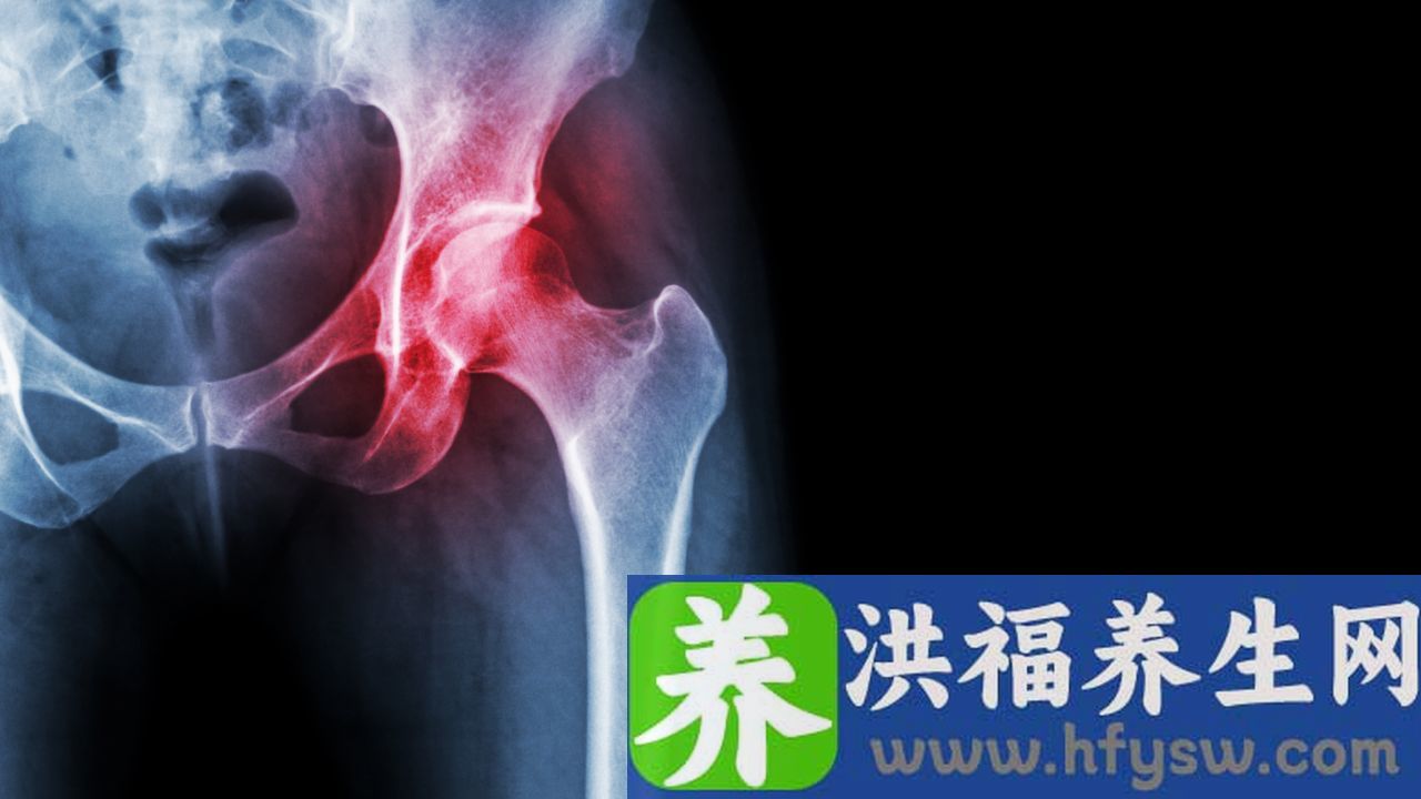 股骨头坏死能好吗